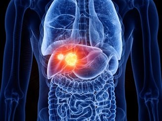 Sterydy, a nowotwory wątroby - mity czy realne zagrożenie?