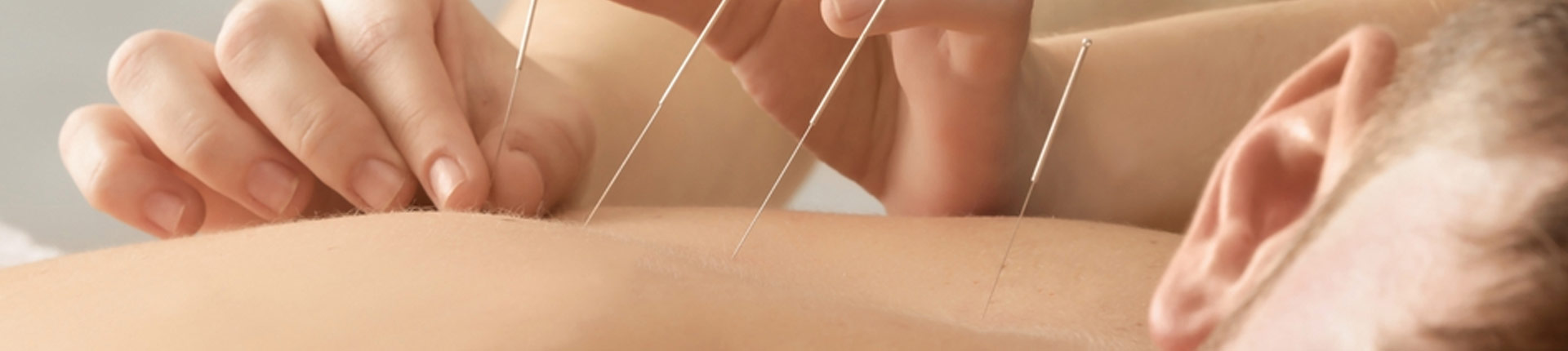 Co daje akupunktura, czy akupunktura leczy i pomaga?